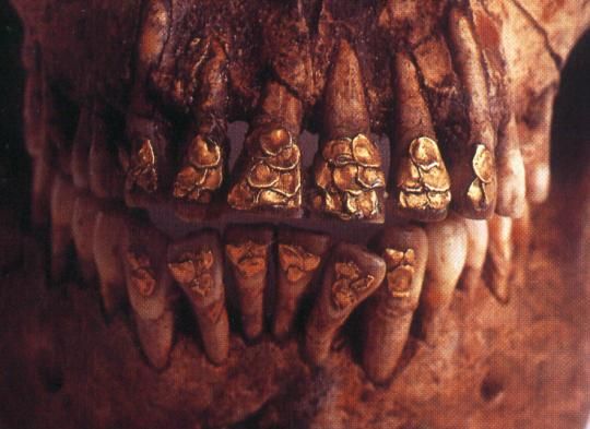 The Bolinao Skull with Teeth Ornamentation (14th-15 century AD) | Tooth  gem, Ancient origins, Ancient maps
