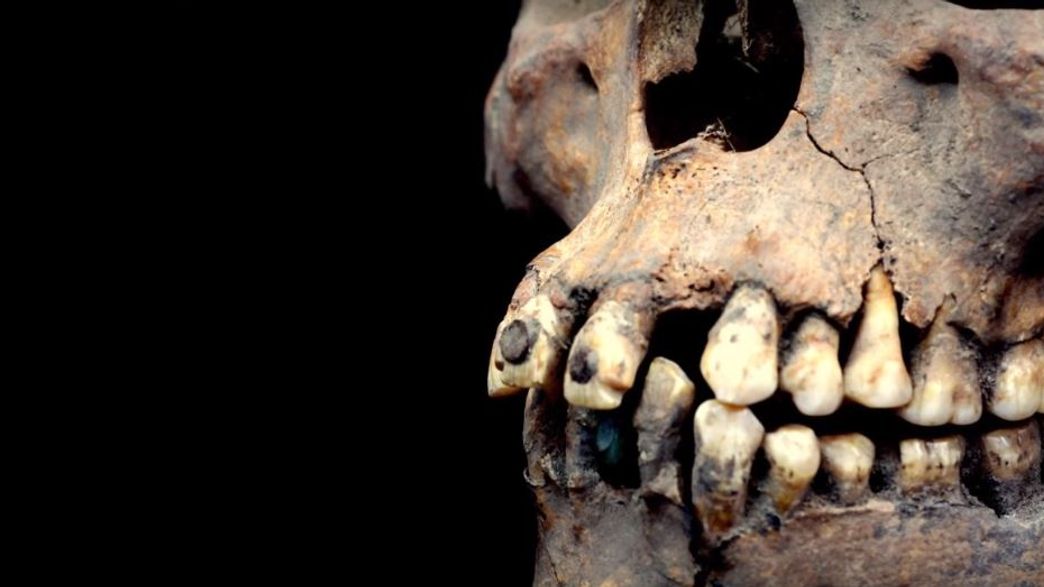 Pre-Aztec Skull With Stone-Encrusted Teeth Discovered At Ancient City In Mexico | IFLScience