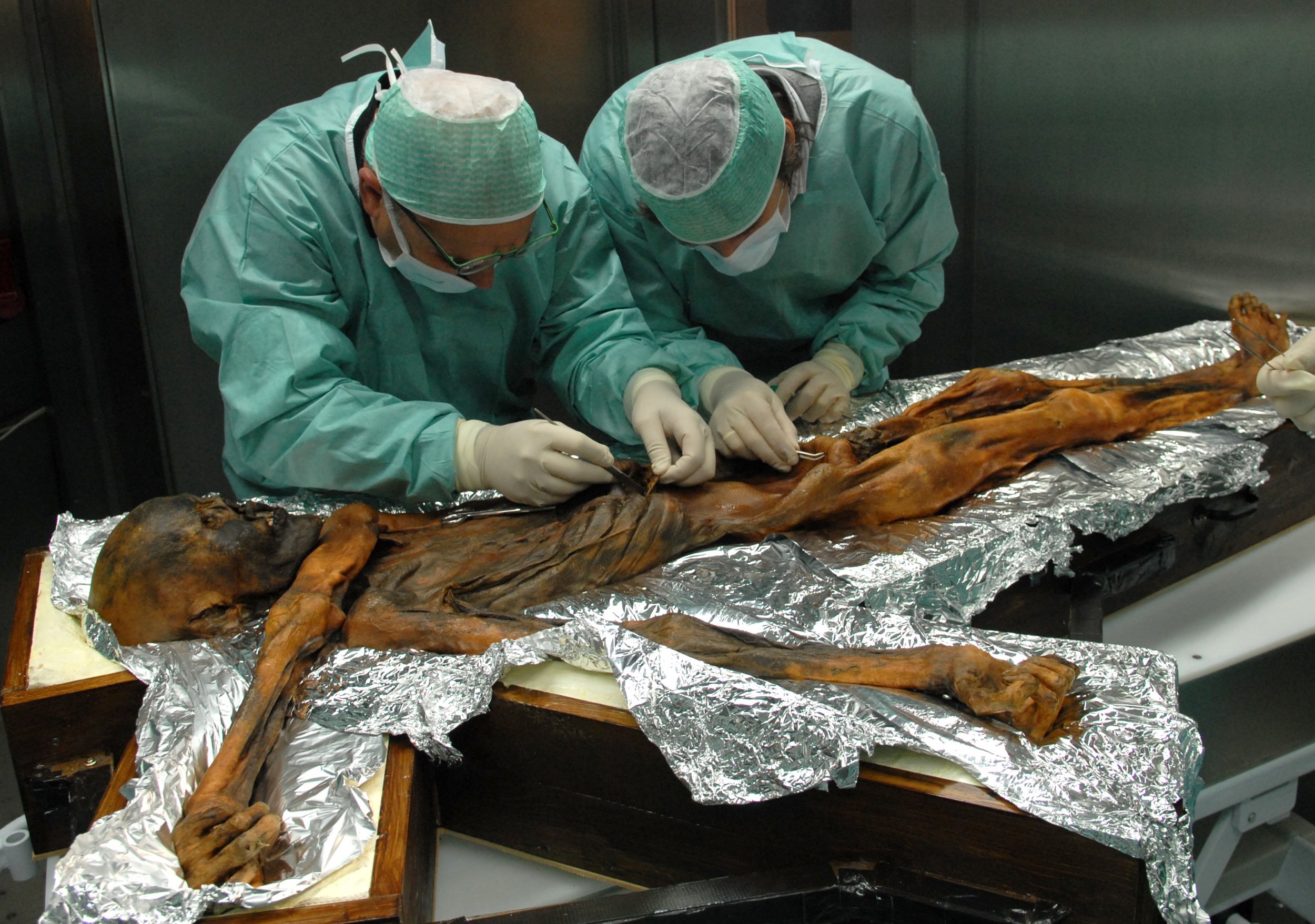 Ötzi the Iceman: 5,300-year-old Mummy's Last Meal Reveals Secrets of  Ancient Diets