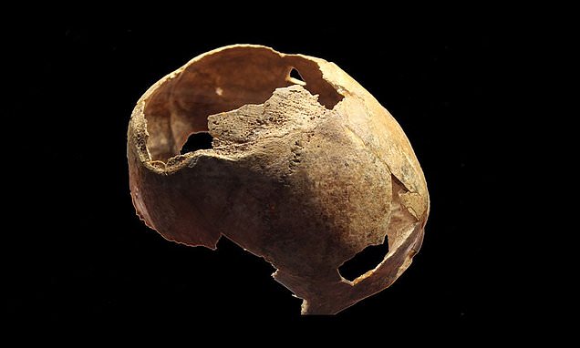 Russian archaeologists unearth the skull of a 5,000 year old man who  underwent ancient brain surgery | Daily Mail Online