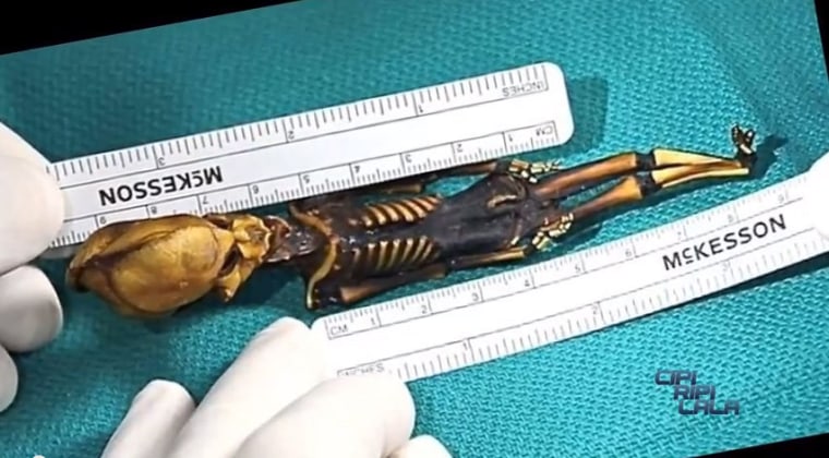 Teensy alien-looking skeleton from Chile poses a medical mystery