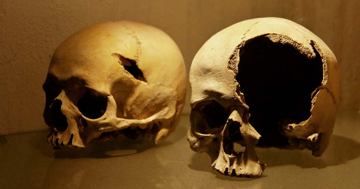 Skeletons Show Horrific Injuries from The Battle of Towton (Video) | Ancient Origins