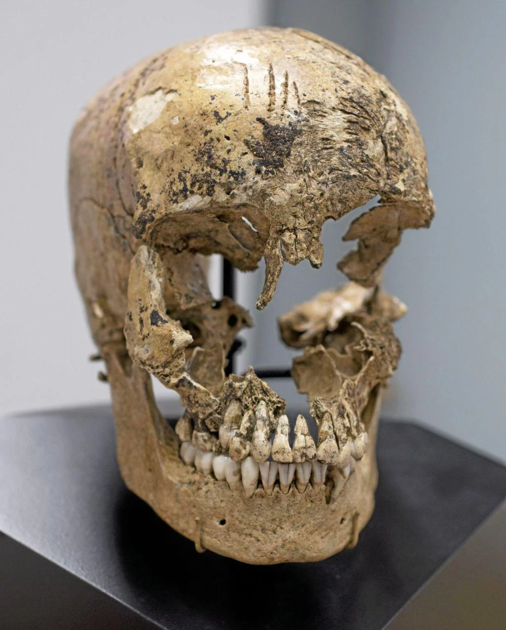 The skull of a 14 year-old girl believed to be a victim of cannibalism at the  Jamestown colony in the winter of 1609