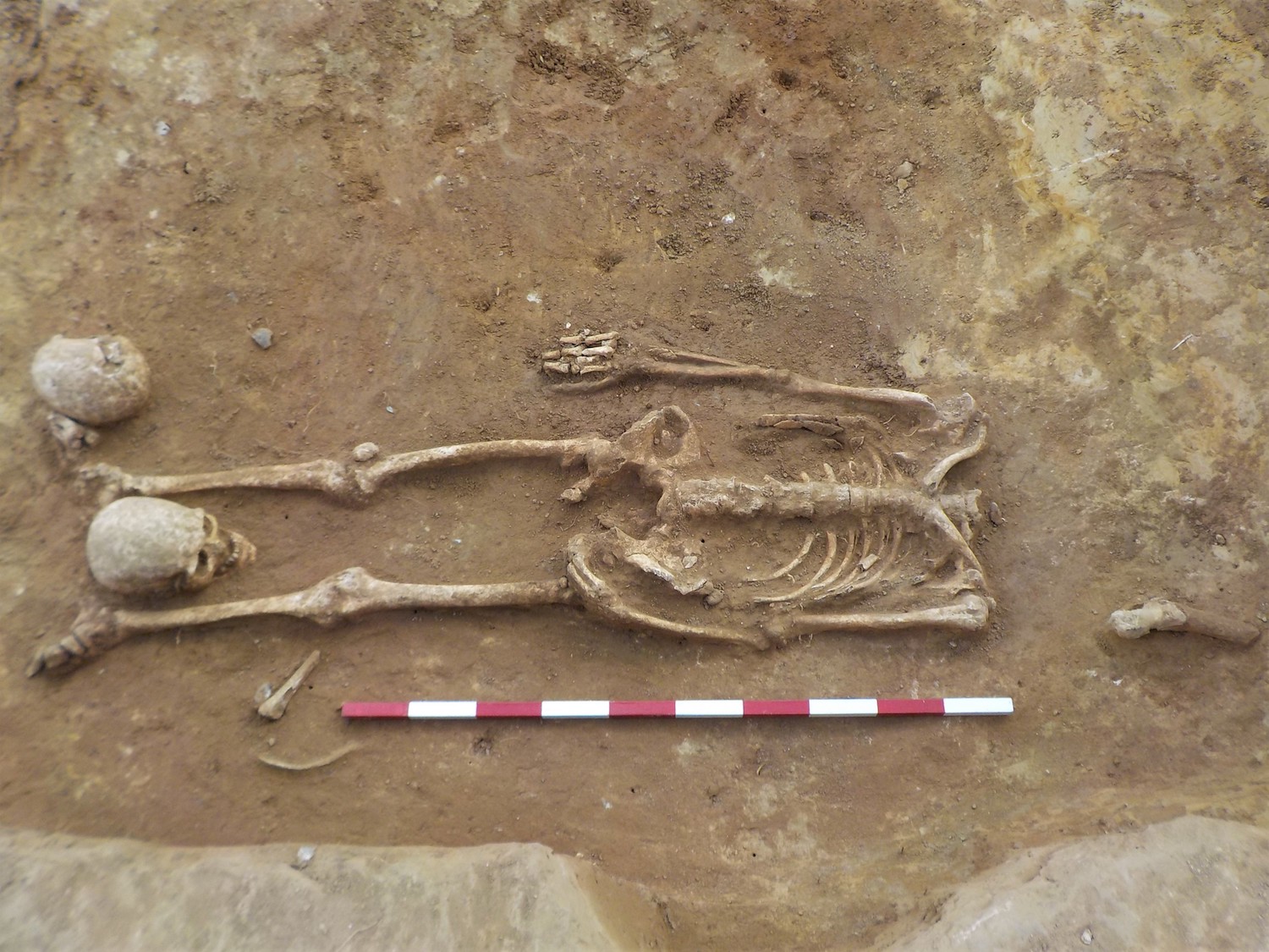 Decapitated Skeletons, with Heads Between Their Legs, Unearthed in Roman Cemetery | Live Science