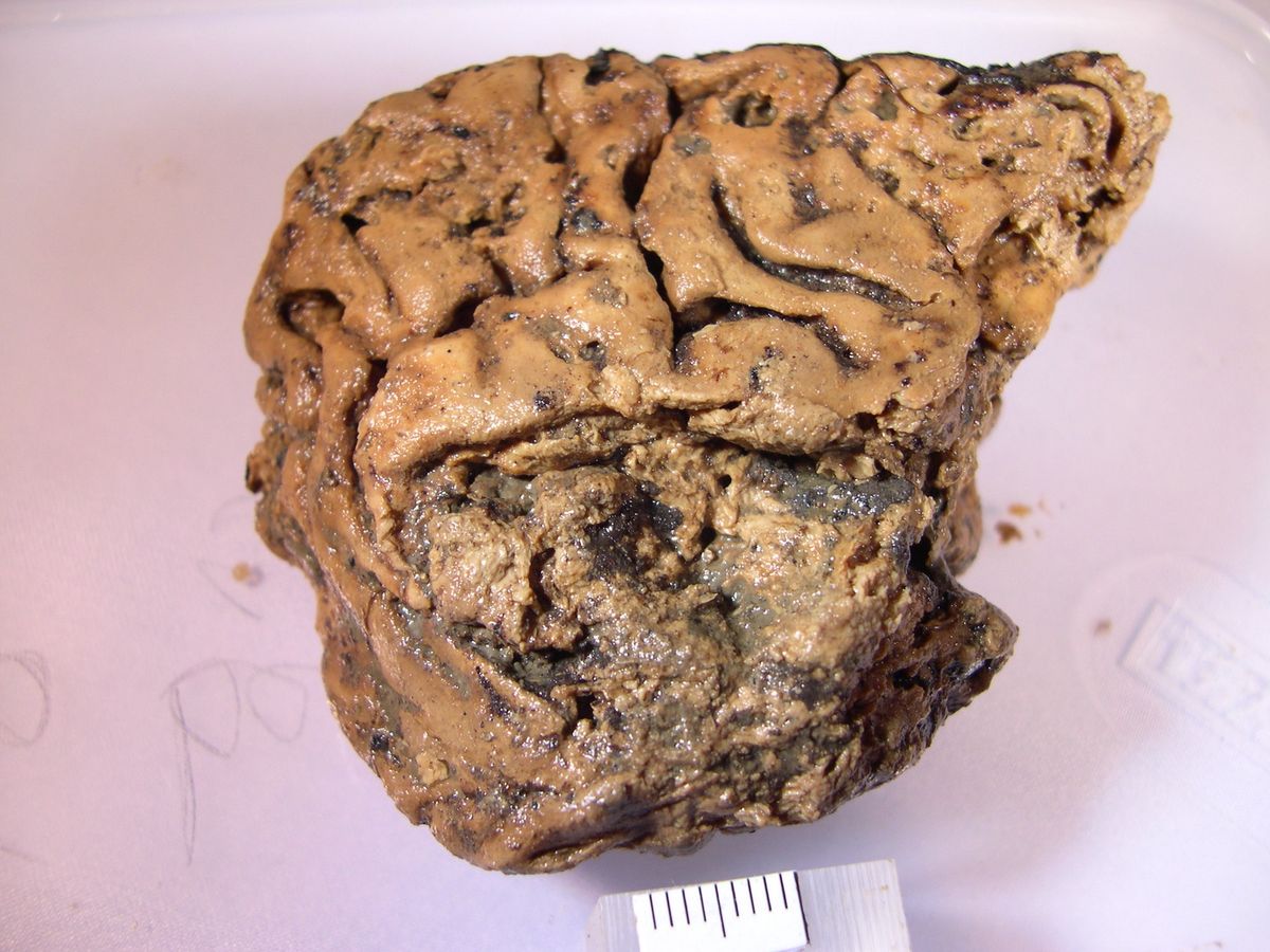 Incredible 'Heslington Brain' Resists Rotting for 2,600 Years. Here's How.  | Live Science