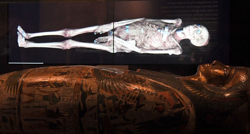 Radiologists Unwrap a 2,300-Year-Old 'Golden Boy' Mummy from Egypt Via CT Scans | Tech Times