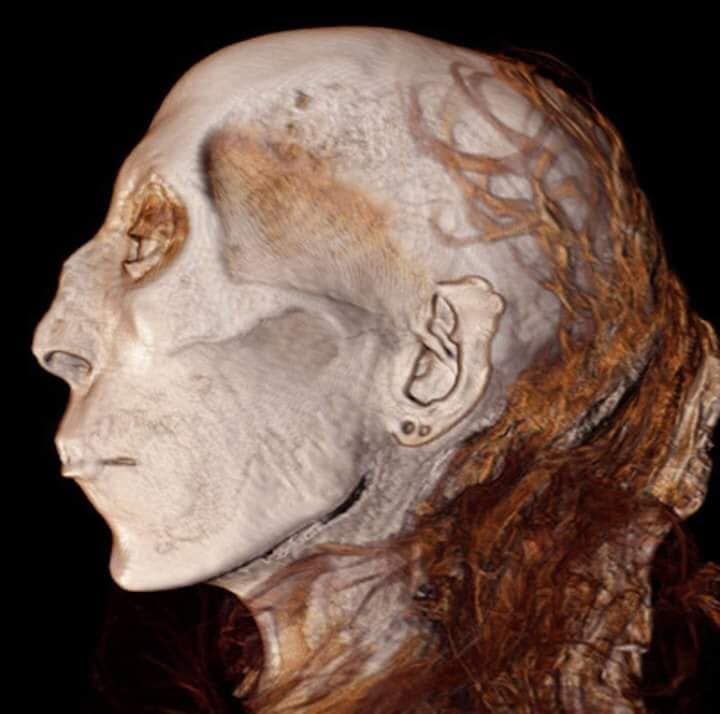 C.T. Scan of Thuya's mummy in profile view.