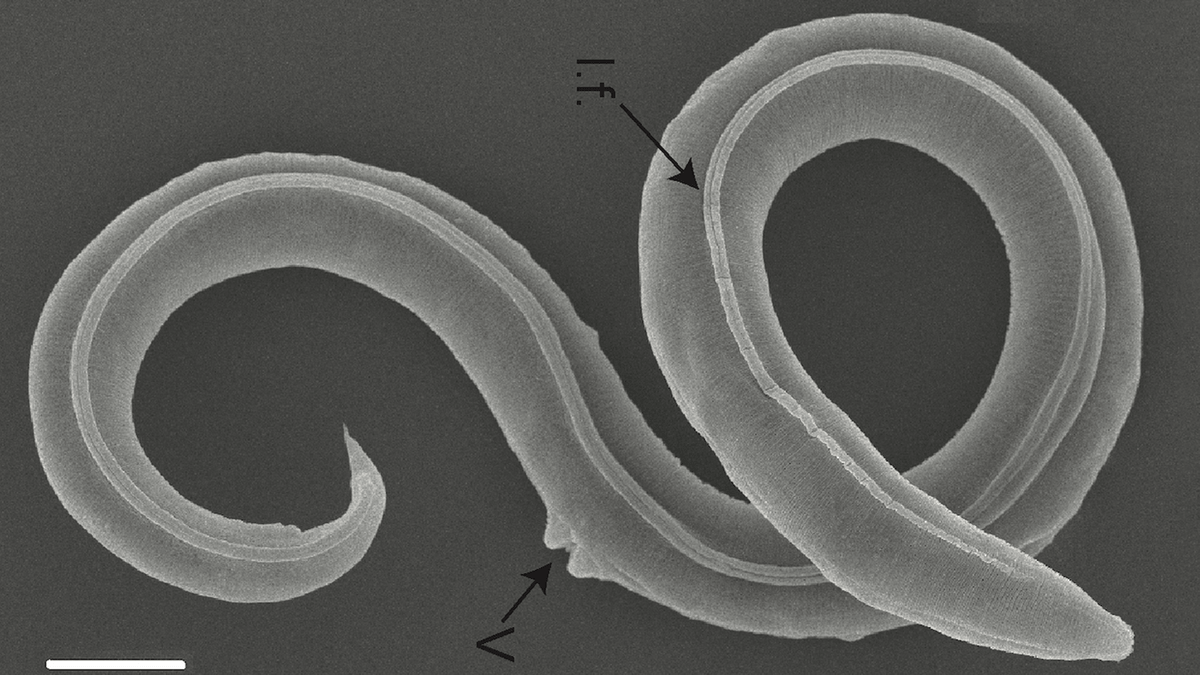 A nematode that had been sleeping for 46,000 years in the Siberian  permafrost revived and bred, and genome analysis turned out to be a ``new  species'' - GIGAZINE