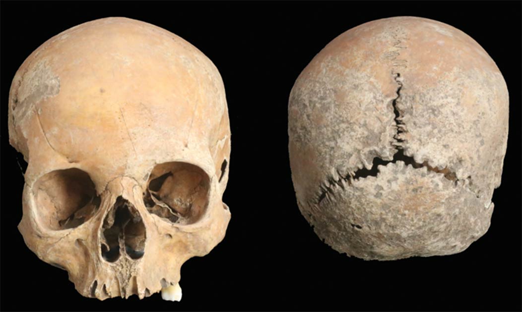 Anglo-Saxon Woman's Lips, Nose and Scalp Sliced Off – But Why? | Ancient Origins