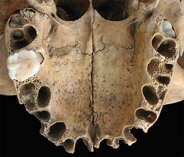 Occlusal view of the maxilla, showing the erupted left first molar. The third molars are visible in their crypts. (G. Cole / Antiquity Publications Ltd)