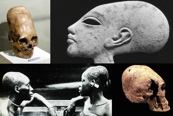 A Look At Theories About Elongated Skulls In Ancient Peru,, 59% OFF