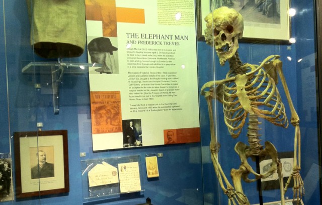 Joseph Merrick, Elephant Man, London Hospital Museum - Travel Darkly