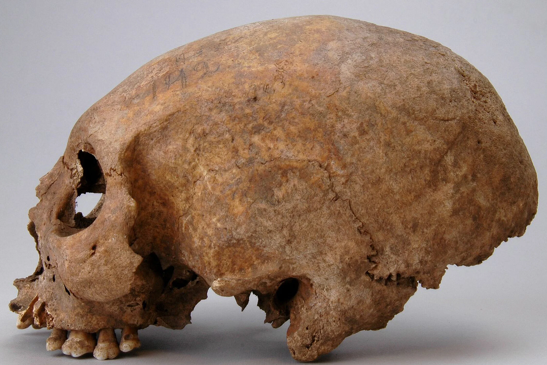 Intriguing Skull Modifications Discovered in Viking Women - Medievalists.net