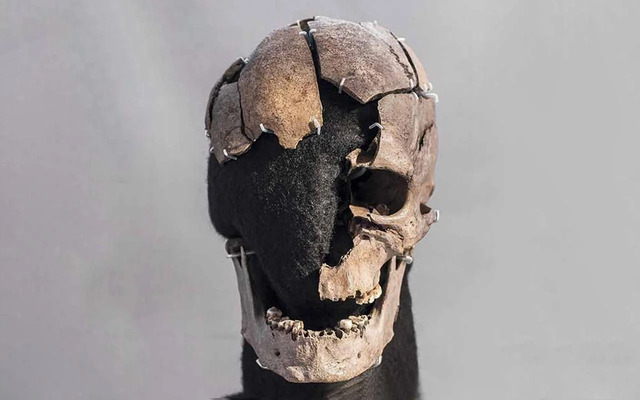 The cranial remains of Vittrup Man reveal a gruesome fate—his skull was crushed by at least eight heavy blows before ending up in a bog.