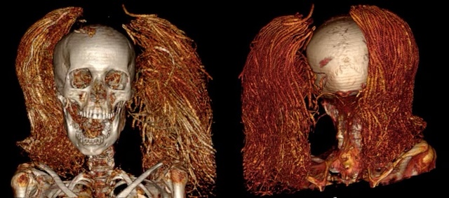 A 3D scan of the "Screaming Woman" mummy, revealing intricate details of her hairstyle, preserved for millennia with ancient Egyptian embalming techniques