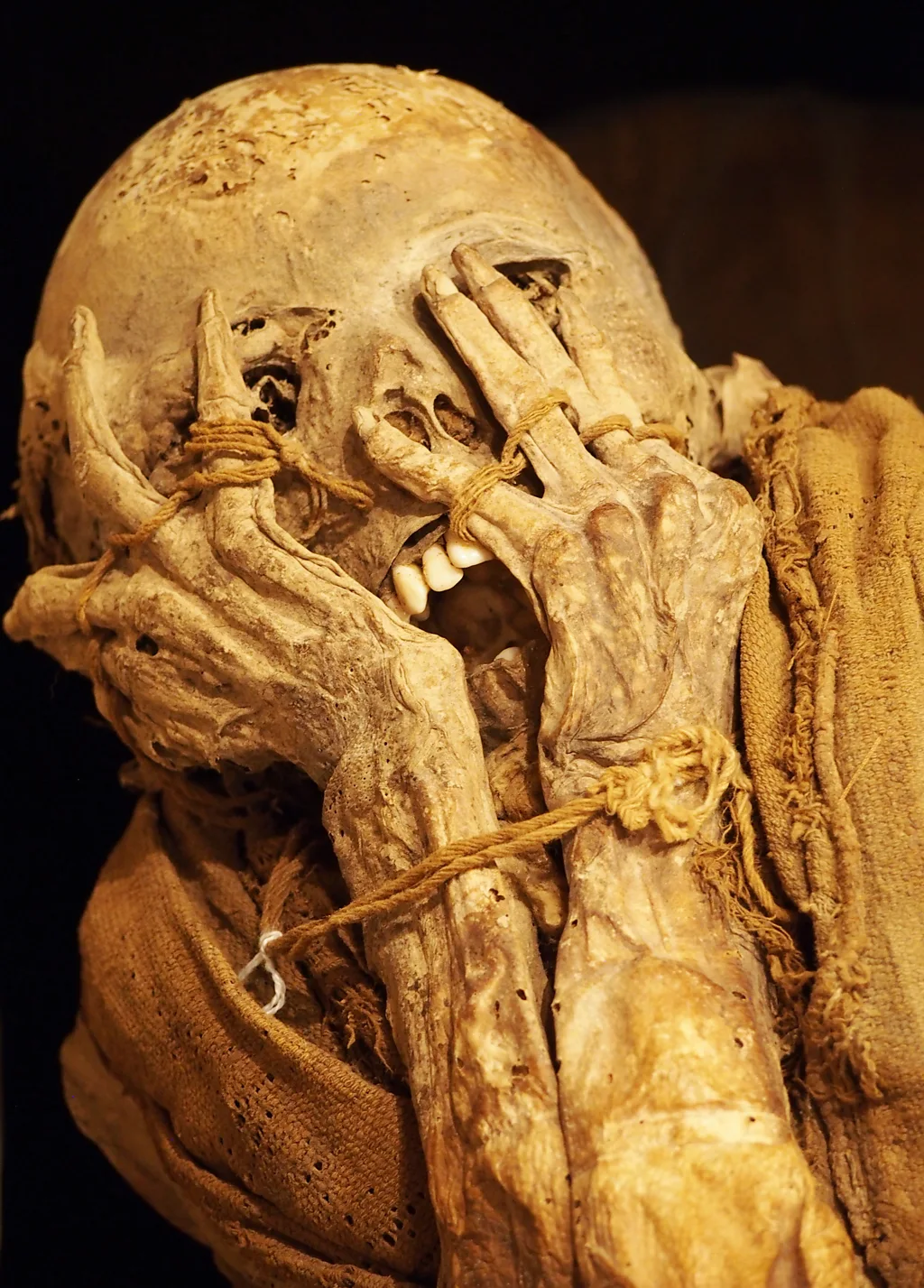 Mummies retrieved from Laguna de los Condores and preserved at the Leymebamba Museum in northern Peru