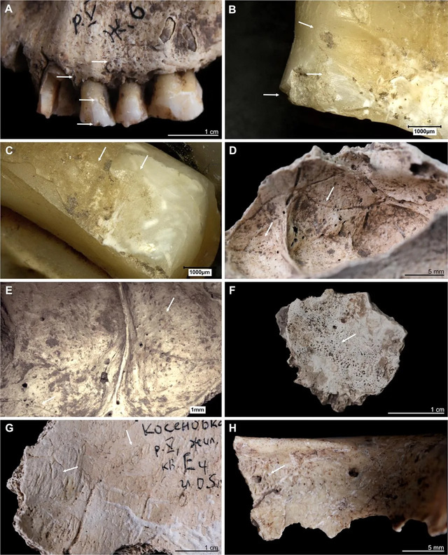 A curated collection highlighting various oral and pathological conditions observed in the findings.