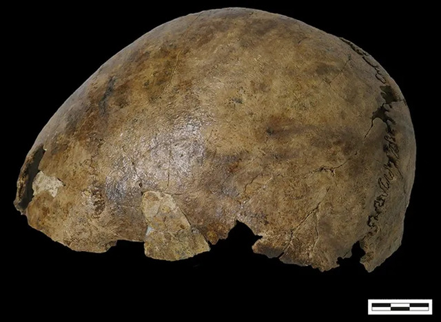 A detailed close-up view of a skull, offering insights into its structural and historical features.