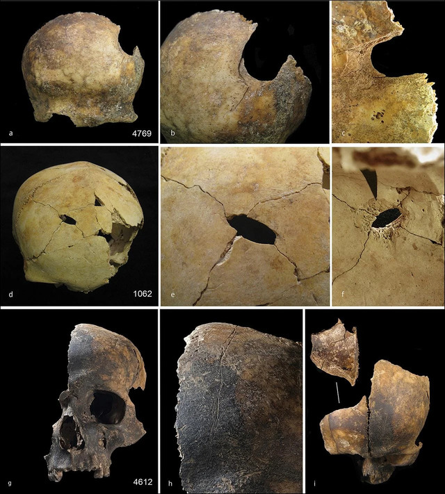 Skulls from the collection display evidence of blunt force impacts and markings consistent with tool use.