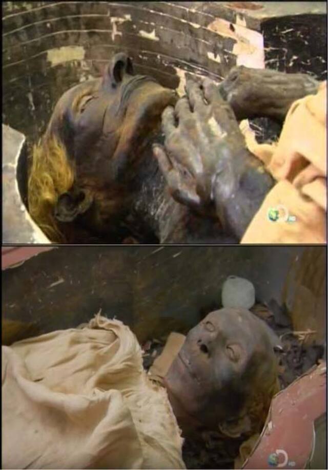 The Well-Preserved Mummies of Yuya and Tuya, Testaments to Their Eminent Status in Ancient Egypt.