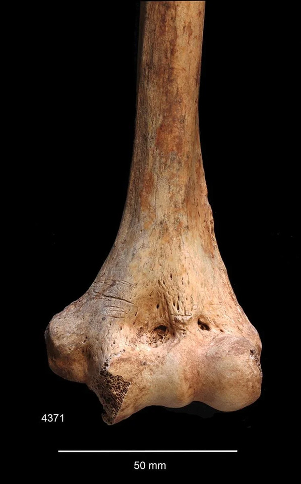 The distal left humerus exhibits linear marks that may indicate postmortem activity.