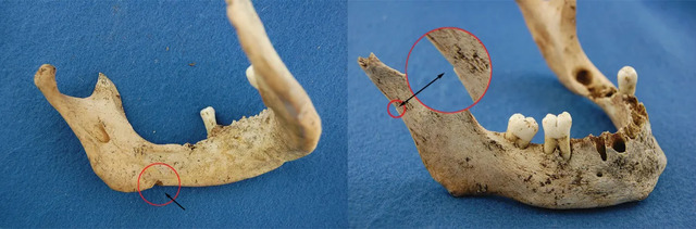 Two perspectives of a jawbone, identified through DNA analysis as belonging to James Fitzjames, reveal cut marks indicative of cannibalism, as highlighted by the arrows.