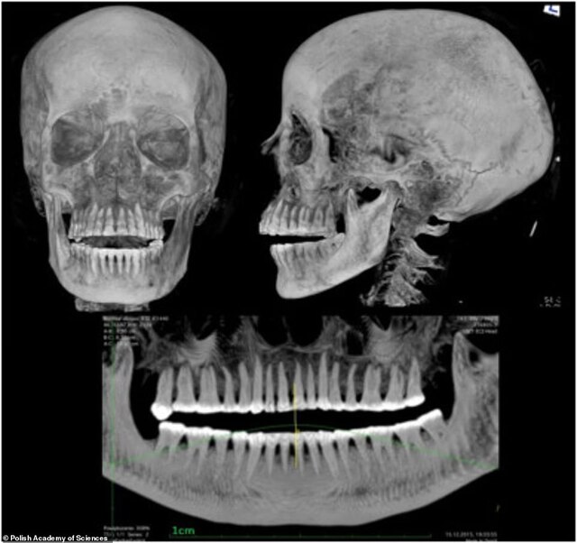 X-rays and CT scans unveil a 26-30 week foetus inside the mummy, a historic first.