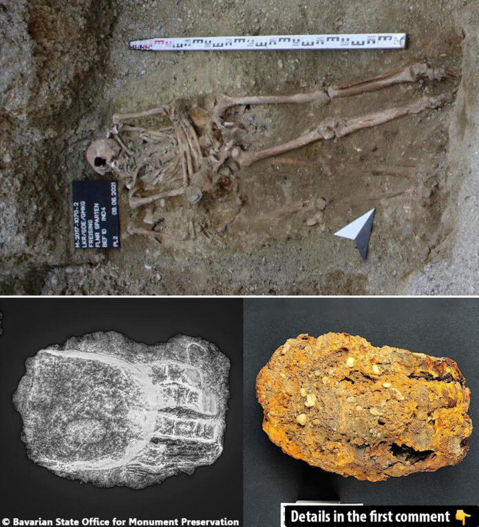 The Mystery of a Medieval Skeleton with an Iron Prosthetic Hand Unearthed in Germany