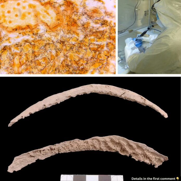 Unveiling the Origins of Syphilis: Ancient DNA Points to the Americas and Colonialism’s Role