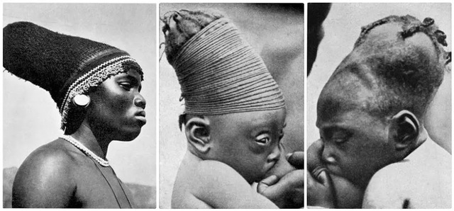 A comparison of Mangbetu cranial modification at various stages. The images illustrate the transition from infancy to adulthood and the cultural emphasis on achieving the elongated head shape.