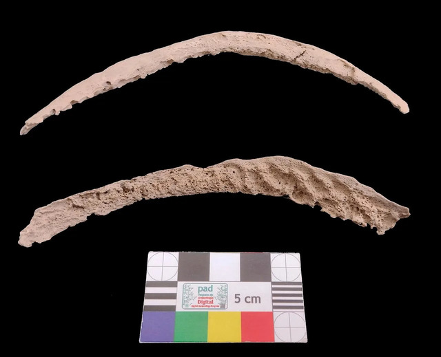 A fragment of an upper hip bone that revealed an ancient genome resembling syphilis.