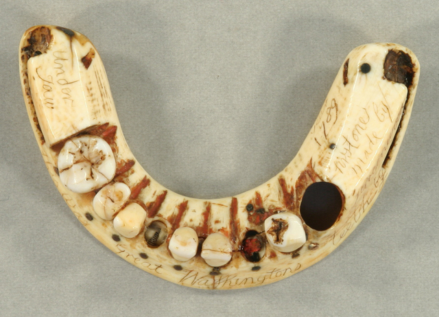 Graciously loaned by the New York Academy of Medicine, this partial set of dental prosthetics was displayed at Mount Vernon from September 2009 to June 2013.