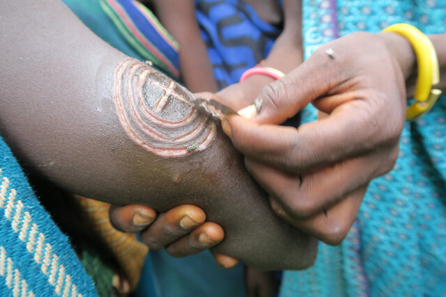 The Surma people create intricate body scars using razors or thorned branches, rubbing ash into the wounds to produce raised patterns that hold deep cultural significance. (Credit: Jayne Mclean) 