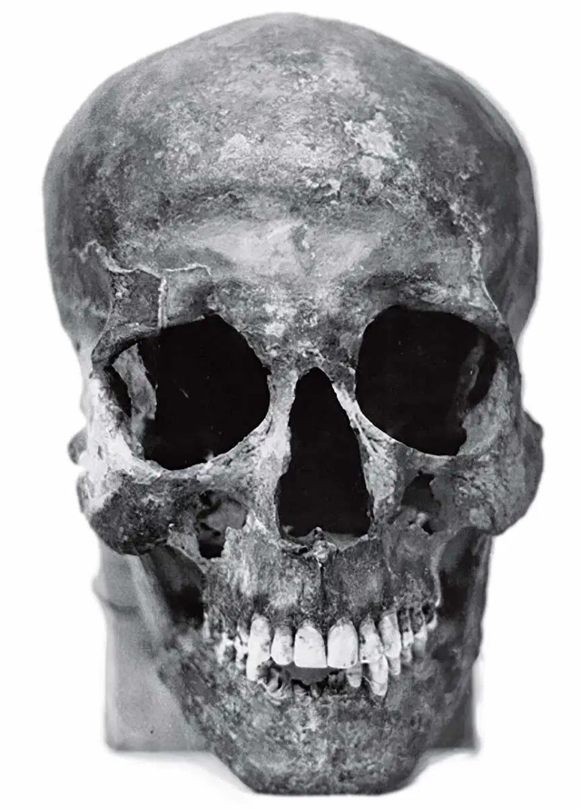 The skull of the KV55 mummy, as studied in Dr. Strouhal’s 2010 research on its biological age. (Anthropologie XLVIII/2)