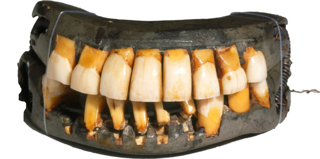 This remarkable set of dental prosthetics, the only complete one known to survive, is preserved in Mount Vernon’s collection.