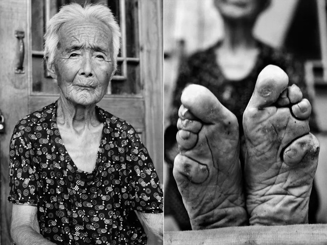 Zhao Hua Hong, one of the last living practitioners of foot-binding, stands as a poignant reminder of a fading tradition. (Credit: Jo Farrell / Living History Project)